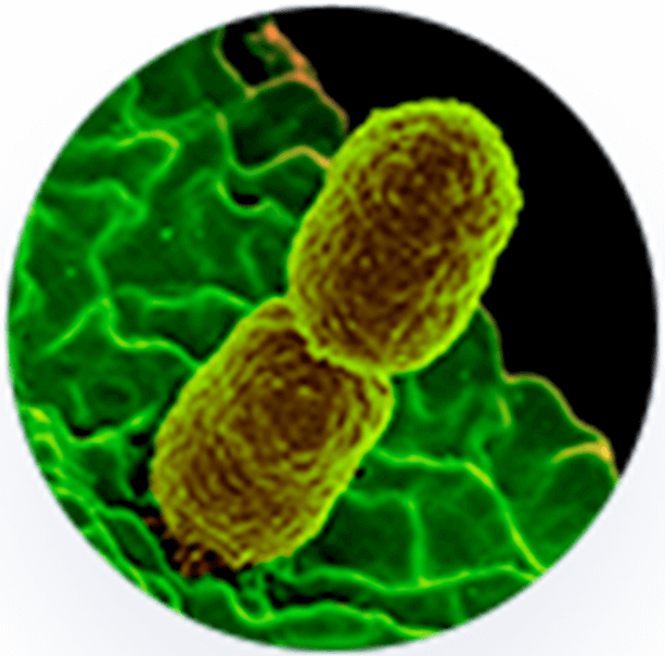 MRSA MRSA